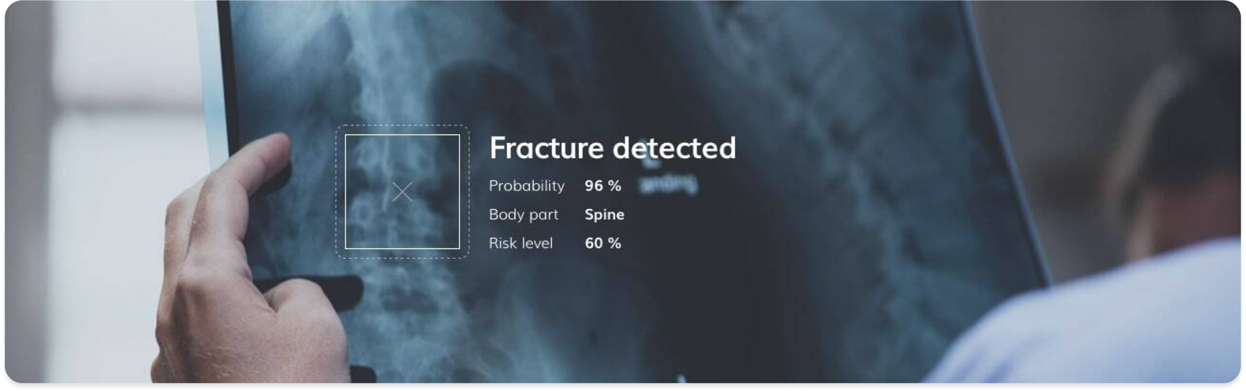 Leverage your biomedical expertise with Ximilar's AI. From microbiology samples to X-rays and skin lesions, machine learning helps capture expert knowledge, automate processes, support lab workers, develop new applications, and improve patient care.