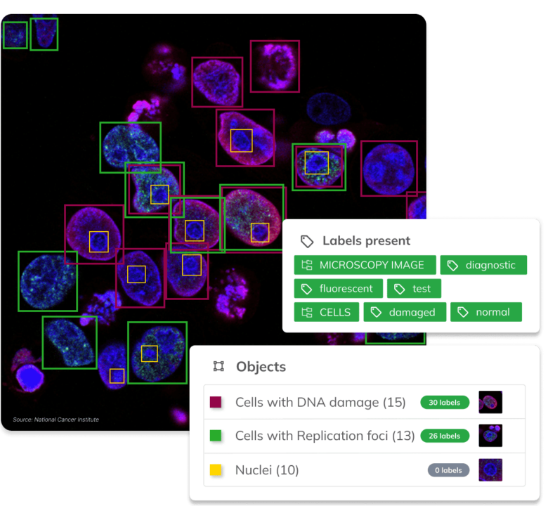 Visual AI by Ximilar can be customized with specific categories, objects, attributes, labels, whole taxonomies or even languages to fit specific use cases. In this case, object detection and image recognition are combined to spot and identify objects in a fluorescent microscopy image.